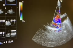 犬猫の心臓病外来について